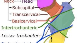 Initial Management of Hip Fractures in Adults