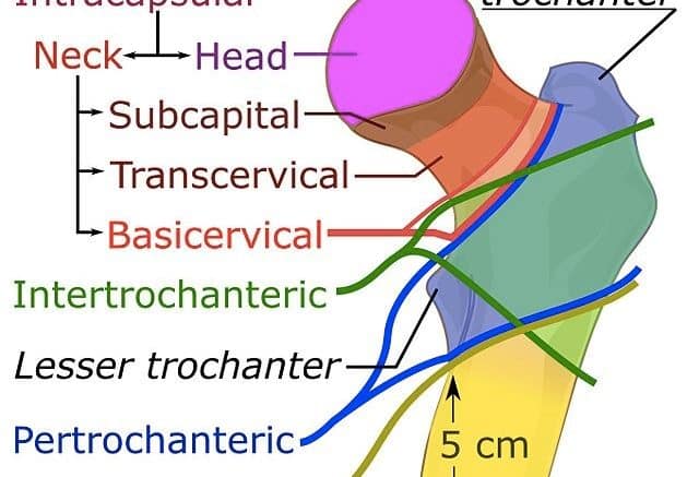 Initial Management of Hip Fractures in Adults