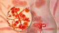 Diagnosis and Management of Vulvovaginitis