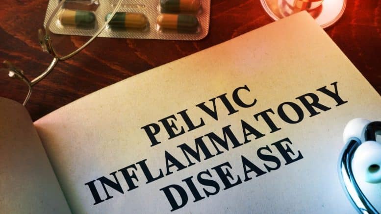 Pelvic Inflammatory Disease