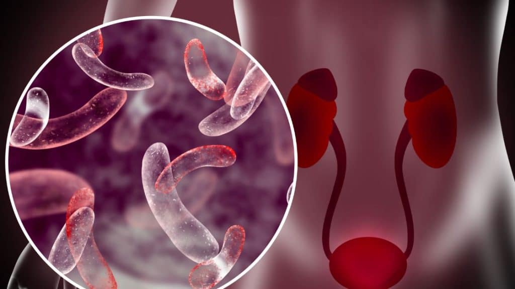 Lower Urinary Tract Infections Doctorable