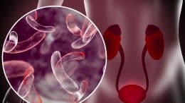 Lower Urinary Tract Infections