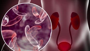 Lower Urinary Tract Infections