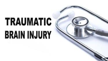 Mild Traumatic Brain Injury
