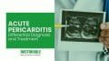 Acute Pericarditis