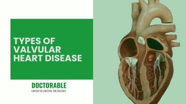 Valvular Heart Disease