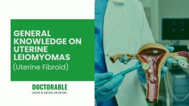 General Knowledge on Uterine Leiomyomas