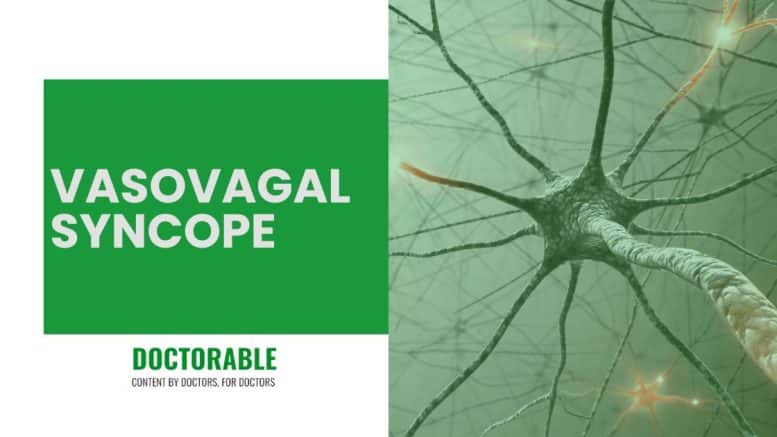 Vasovagal Syncope A General Overview Doctorable