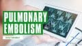 Pulmonary Embolism