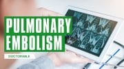 Pulmonary Embolism
