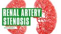 Renal Artery Stenosis