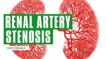 Renal Artery Stenosis
