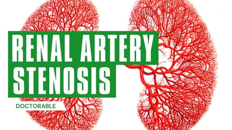 Renal Artery Stenosis